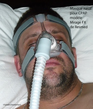 Masque-Nasal-Pour-CPAP-modele-Mirage-FX-de-Resmed-orthodontiste-chamberland-Quebec